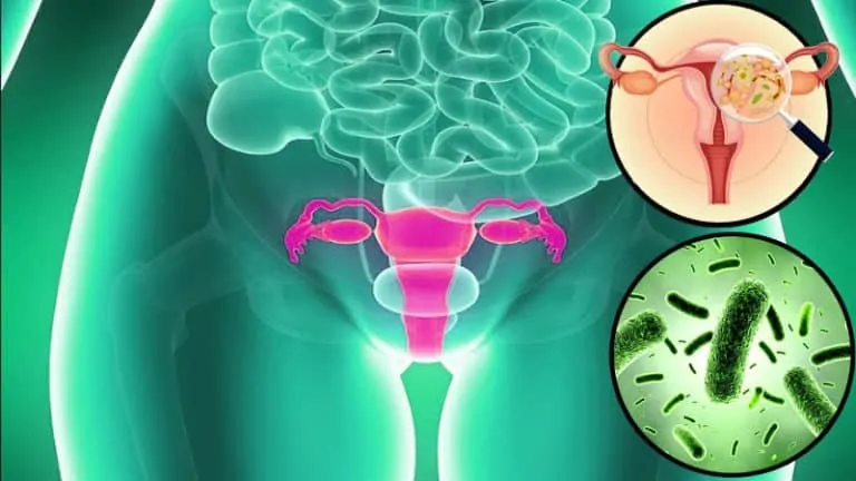 Бактериална вагиноза – какви рискове крие?